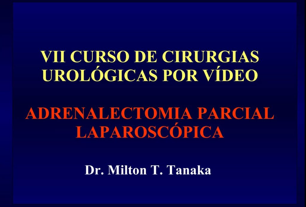 Adrenalectomia parcial videolaparoscópica - Aula Master Clínica