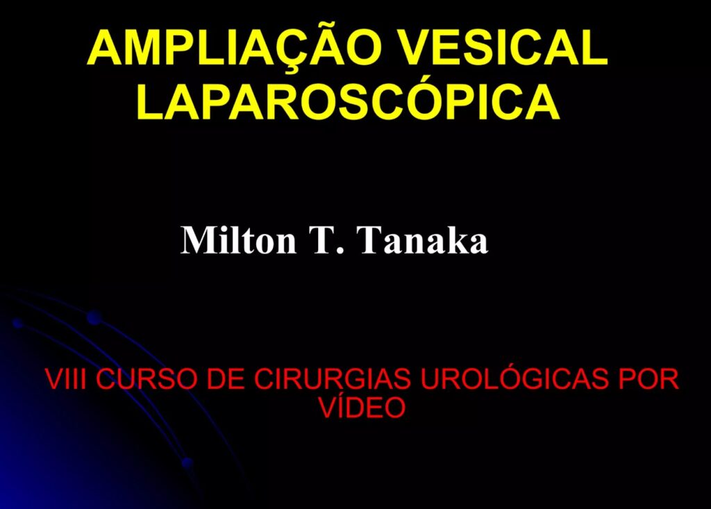 Ampliação vesical laparoscópica - Aula Master Clínica