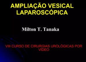 Ampliação vesical laparoscópica - Aula Master Clínica