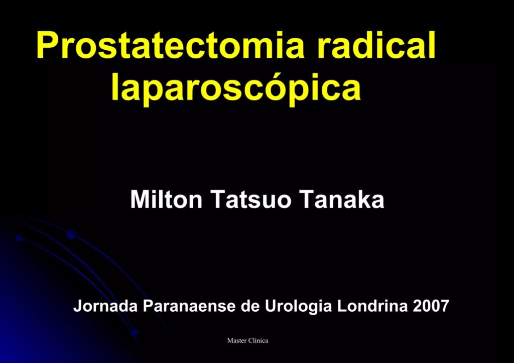 Prostatectomia radical laparoscópica - Aula Master Clinica