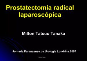 Prostatectomia radical laparoscópica - Aula Master Clinica
