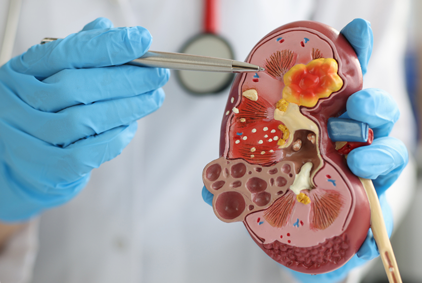 Pioneirismo em Uro-Oncologia