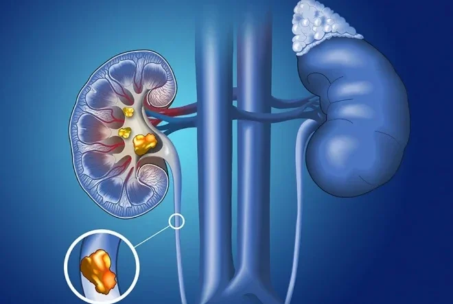 Pioneirismo em endourologia e litotripsia